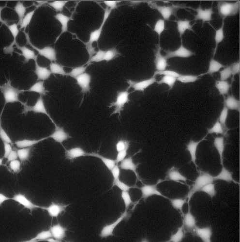 Automated image processing to quantify neurite growth in Luhmes human neuronal precursor cells