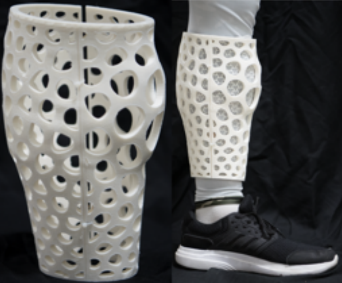 Consistently fitting orthopedic casts