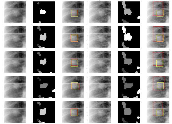 A Novel Marker-less Lung Tumor Localization Strategy on Low-rank Fluoroscopic Images with Similarity Learning