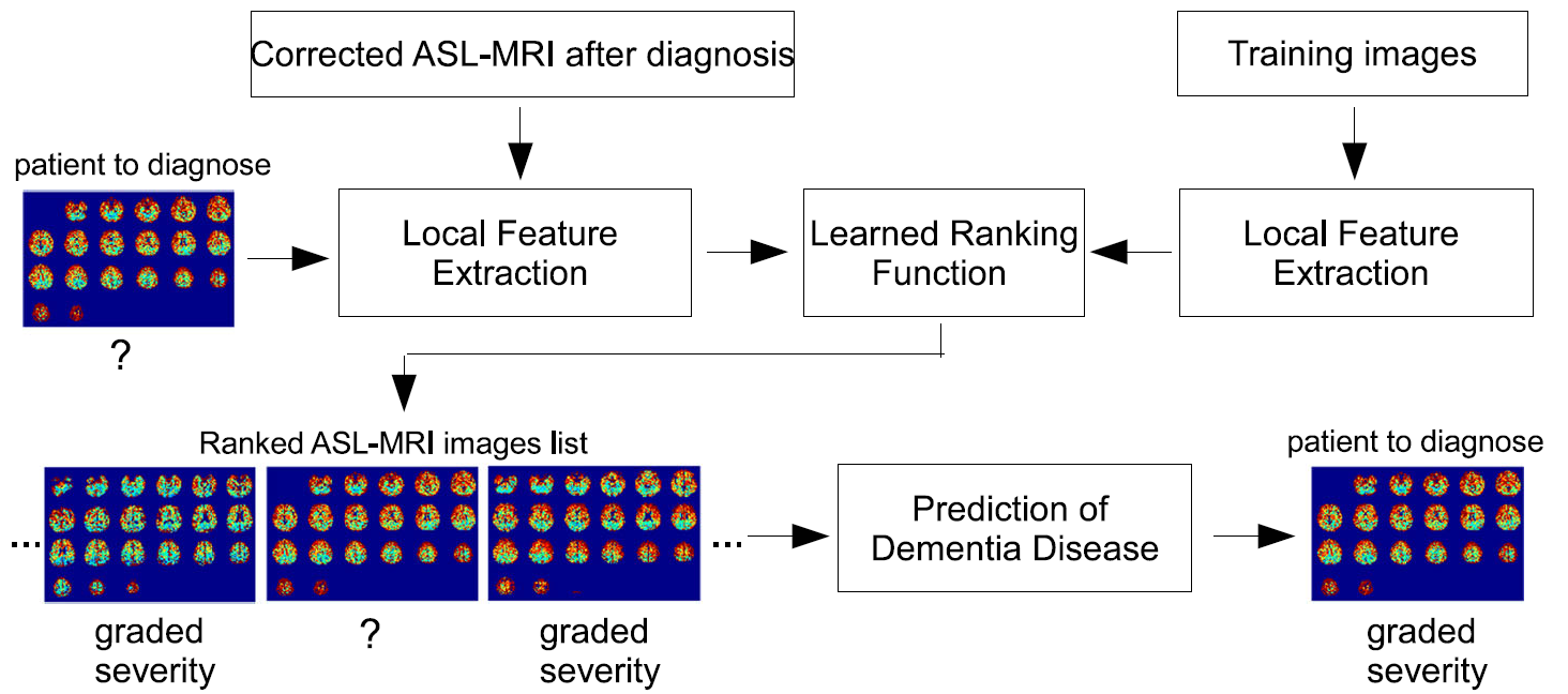 Teaser of A novel dementia diagnosis strategy on arterial spin labeling magnetic resonance images via pixel-wise partial volume correction and ranking